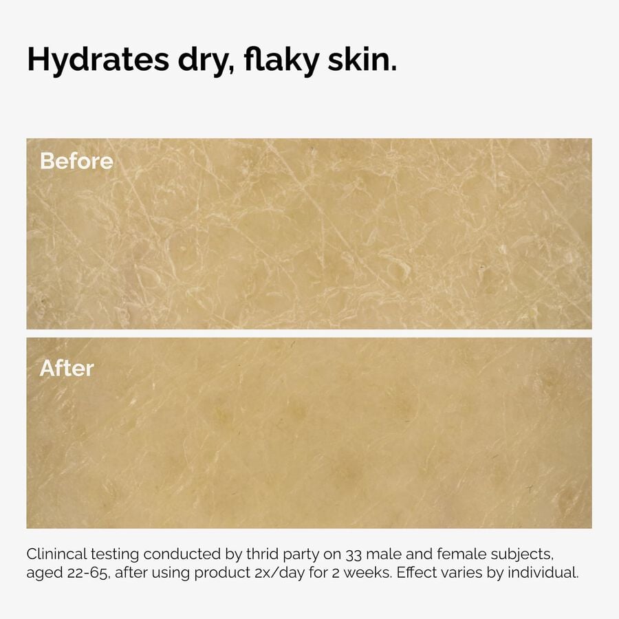 the-body-care-collection-f1 ord-natural-moisturizing-factors-inulin-body-before-after-graphic-02.jpg