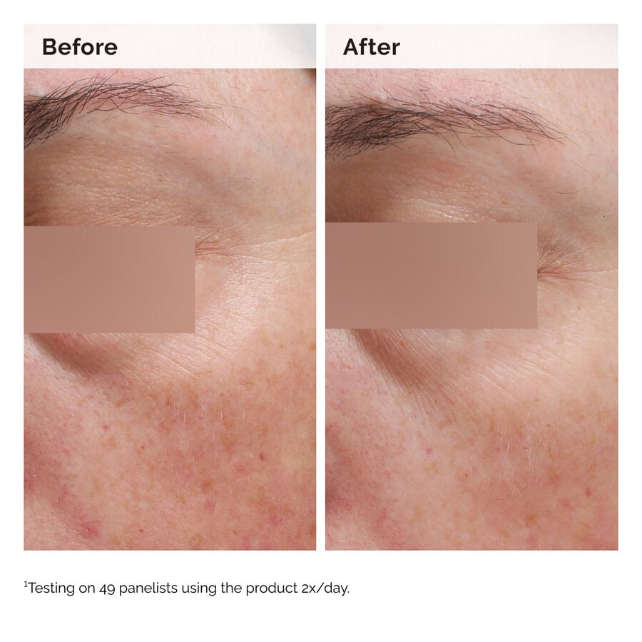 niacinamide-5-face-and-body-emulsion-w4 2024-08-23-ORD-Nia-5pct-Face-Body-B-A-Elasticity-Global-02-1x1.jpg