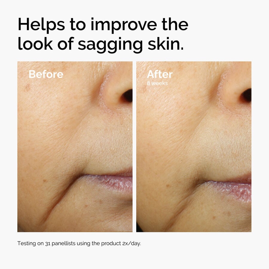 caffeine-3-escin-1-face-serum-w9 ord-caffeine-3pct-escin-1pct-face-serum-before-after-sagging.jpg
