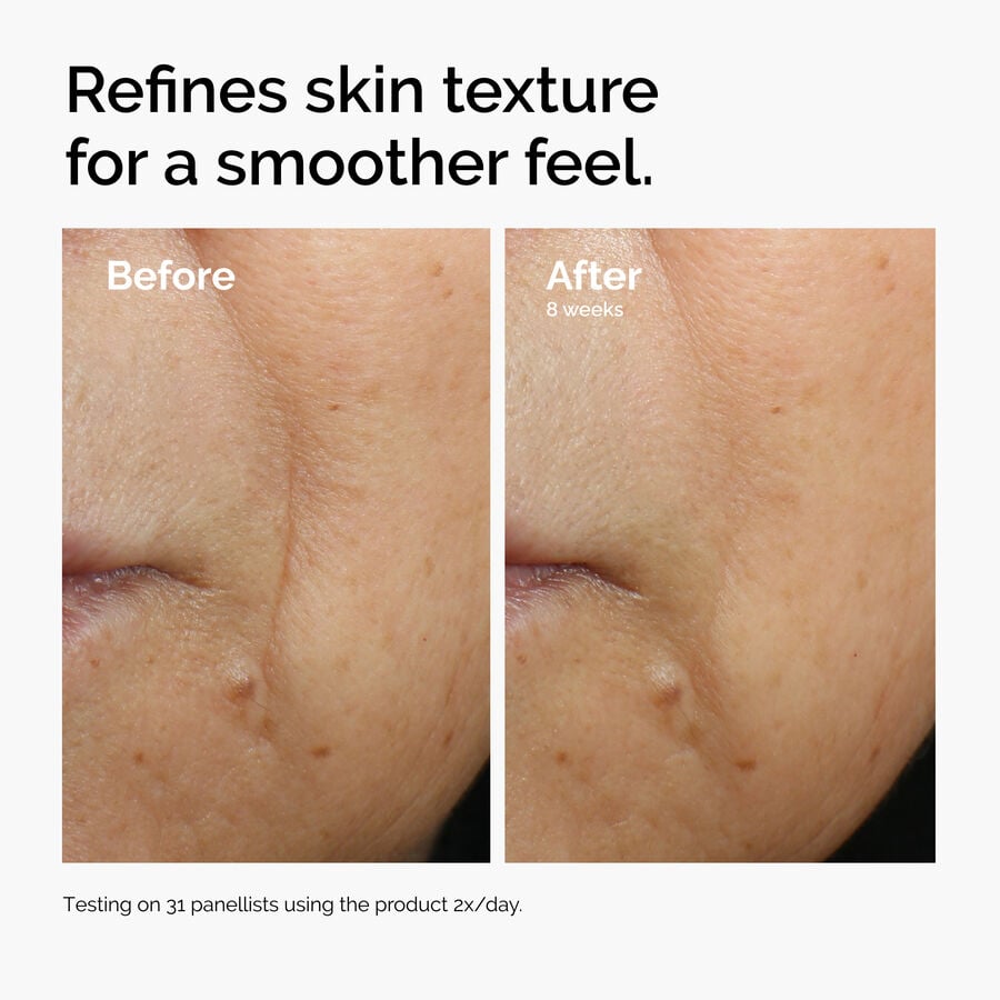 caffeine-3-escin-1-face-serum-w9 ord-caffeine-3pct-escin-1pct-face-serum-before-after-texture.jpg