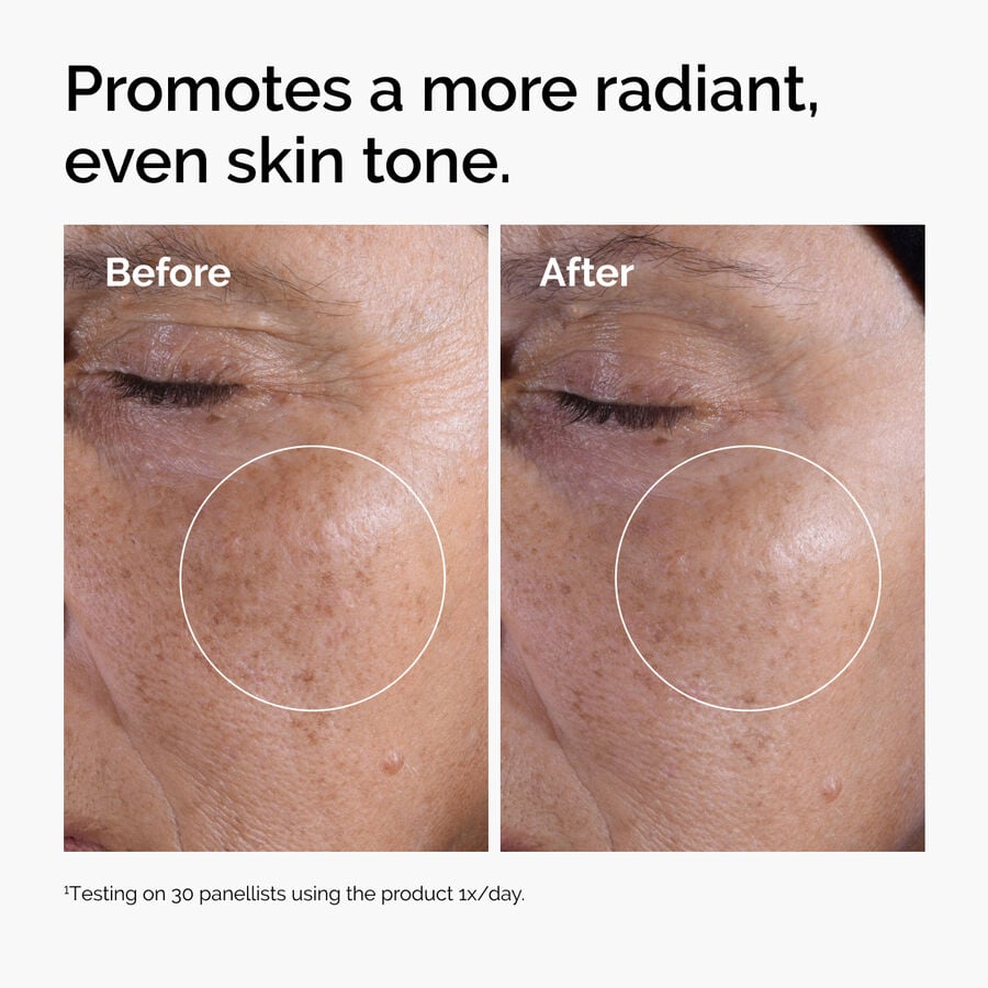 glycolic-acid-7-exfoliating-toner-x9 ord-glycolic-before-after-radiance.jpg
