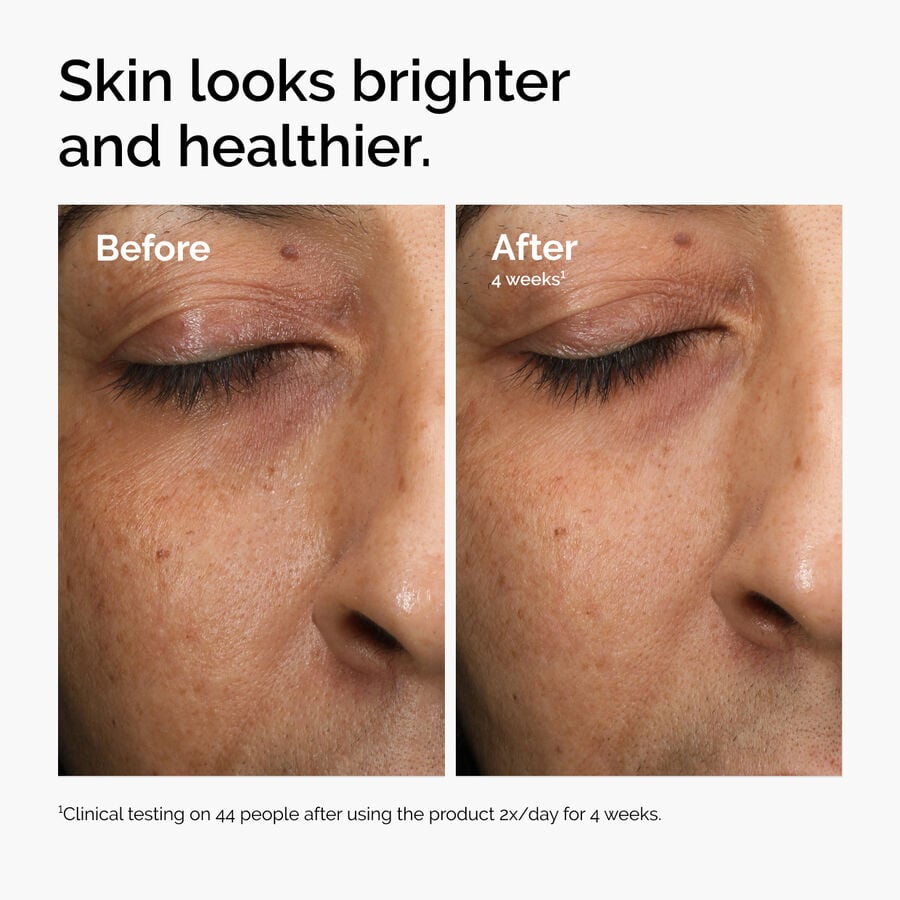 multi-antioxidant-radiance-serum-m5 ord-mars-before-after-healthy.jpg