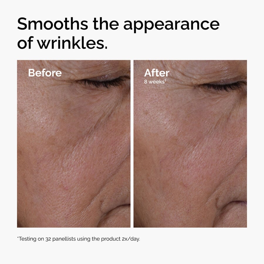 multi-peptide-ha-serum-k7 ord-multi-peptide-ha-serum-wrinkles-before-after.jpg