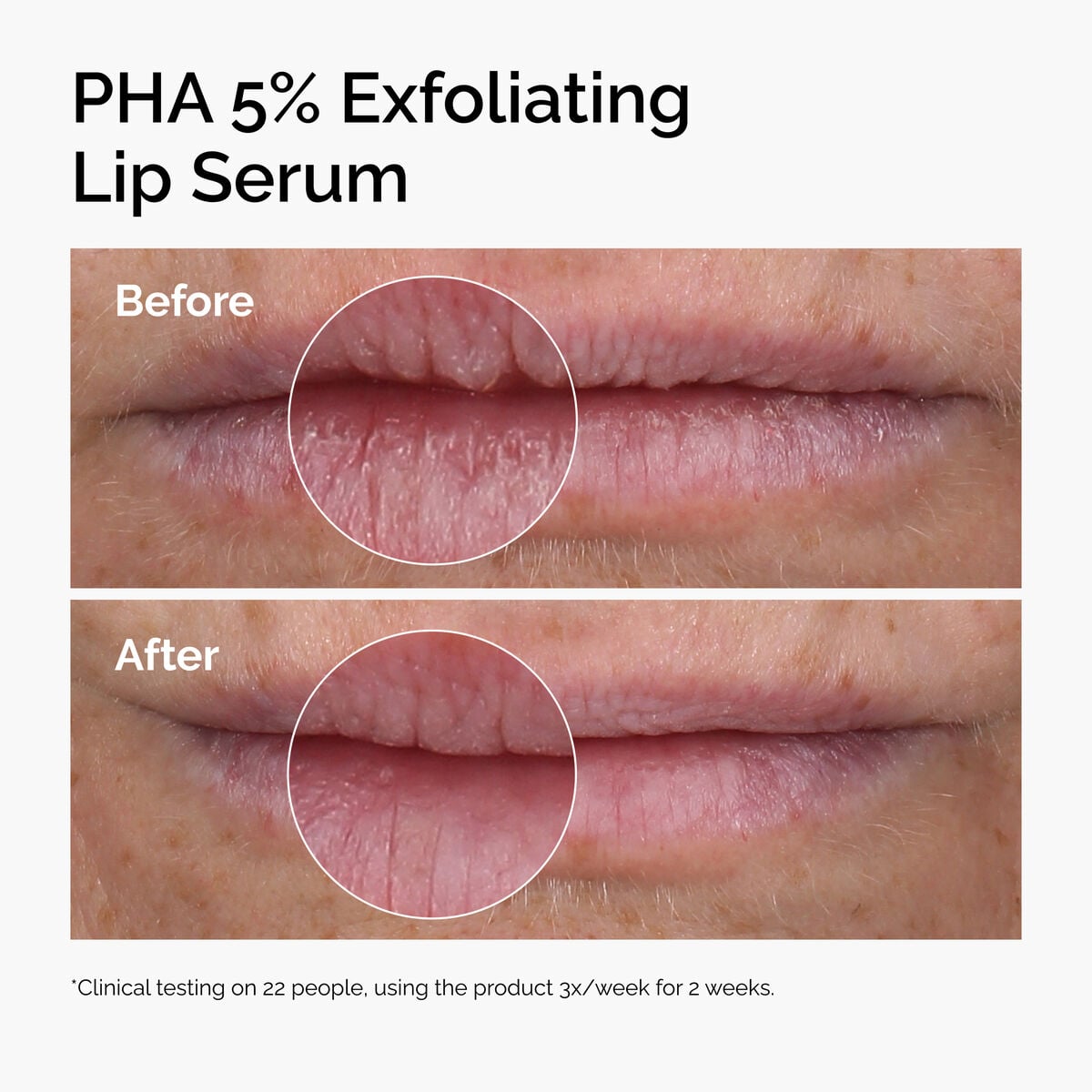 pha-5-exfoliating-lip-serum-e9 ord-pha-5pct-lip-exfoliating-serum-before-after.jpg