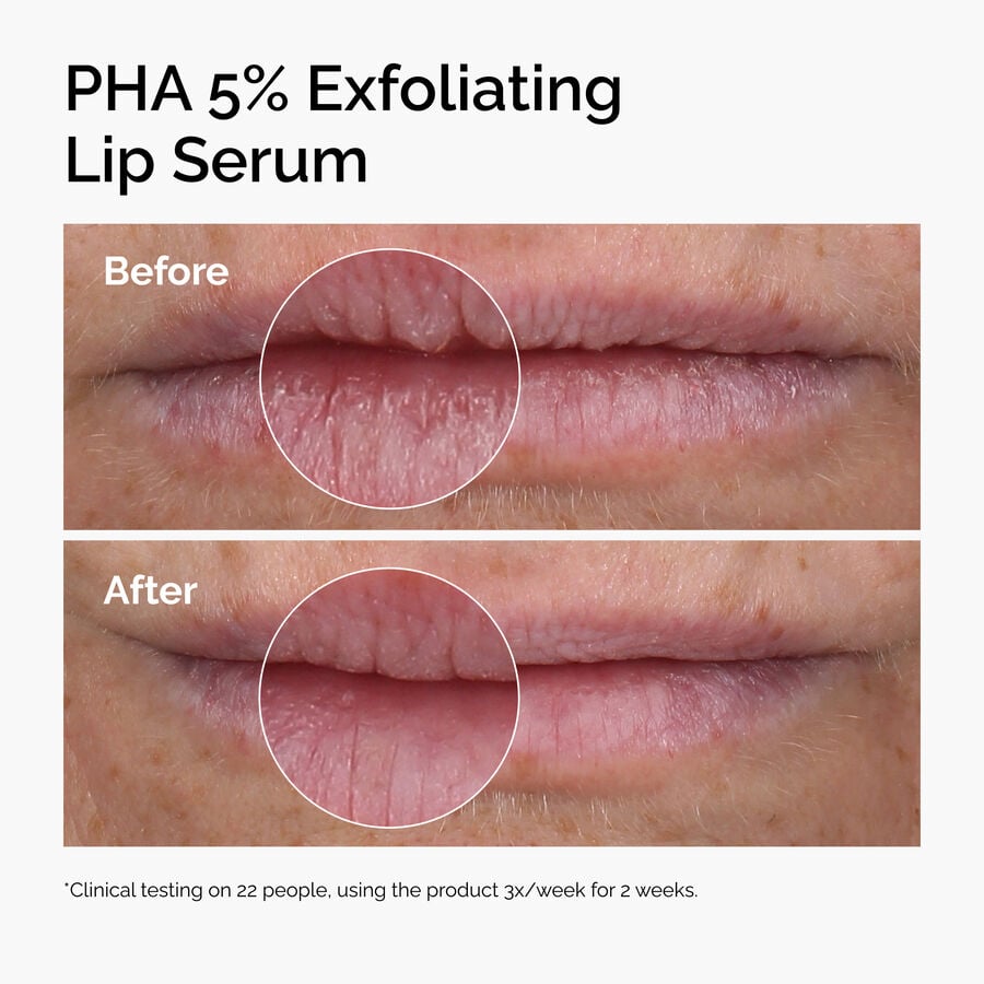 pha-5-exfoliating-lip-serum-e9 ord-pha-5pct-lip-exfoliating-serum-before-after.jpg