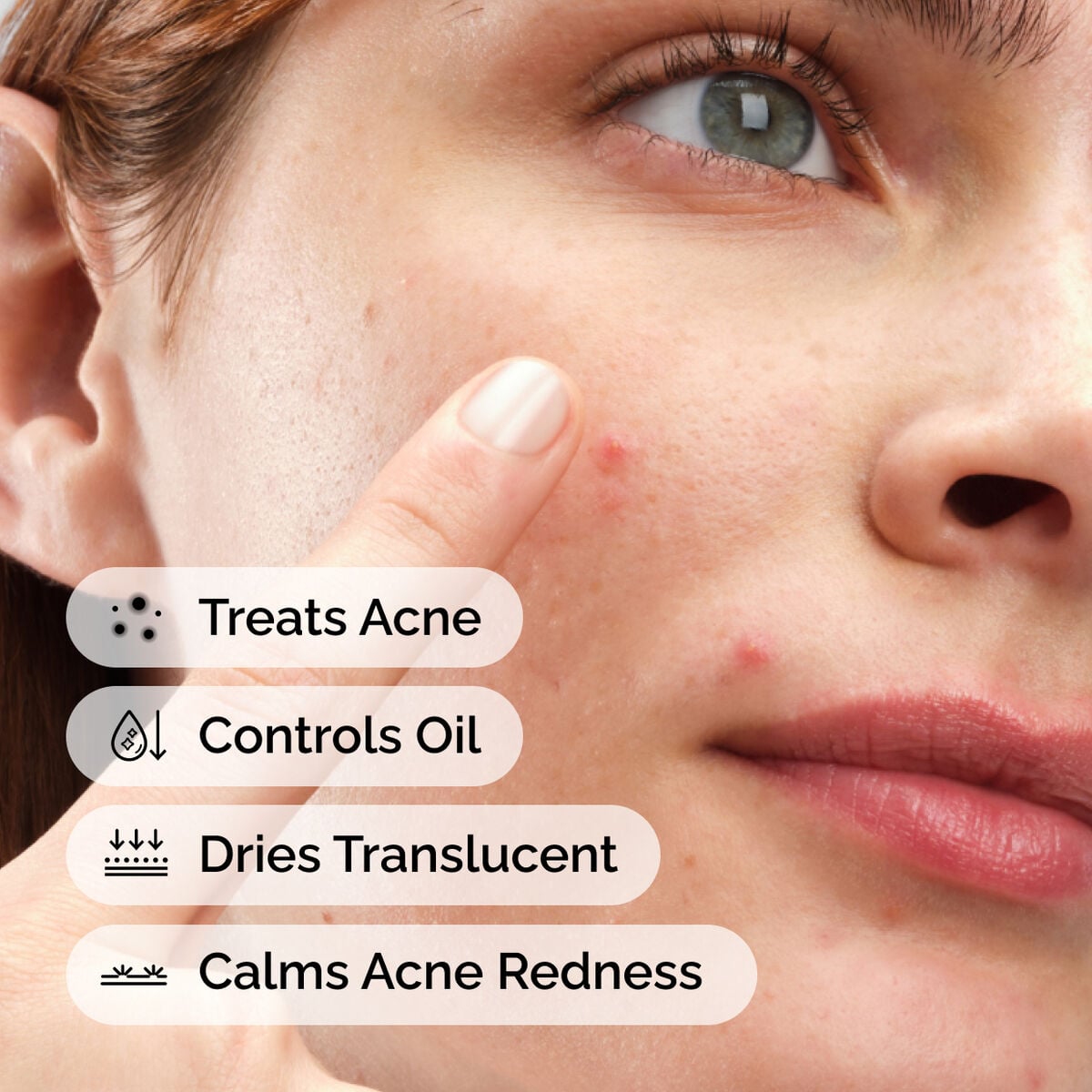 sulfur-10-powder-to-cream-concentrate-e3 ord-sulfur-10pct-powder-to-cream-concentrate-model-application-with-benefits-acne.jpg